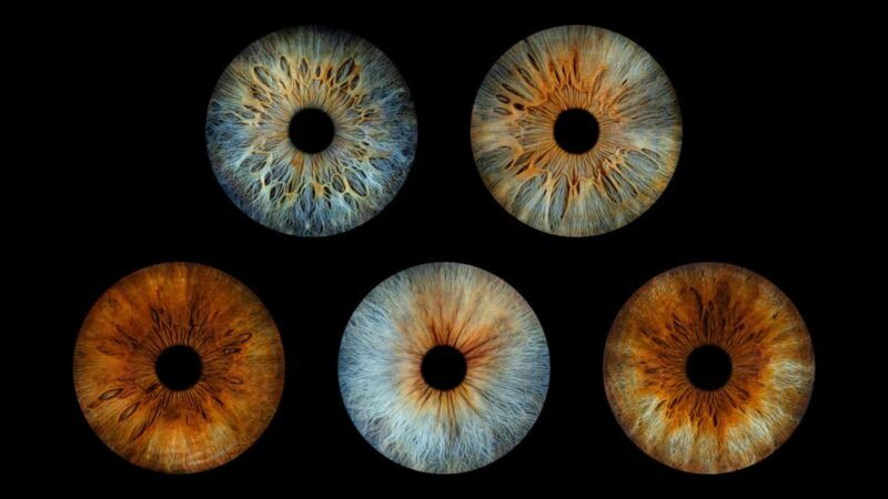 Paris Rivoli: Reveal the beauty of your iris with Iris Galerie - What to Expect from Your Iris Experience